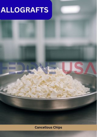 Cancellous Chips