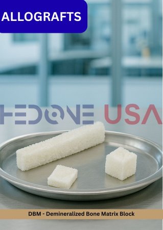 DBM - Demineralized Bone Matrix Block