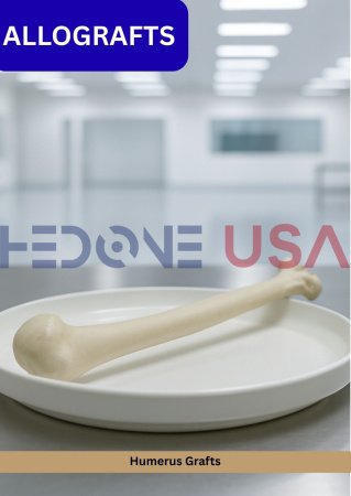 Humerus Grafts